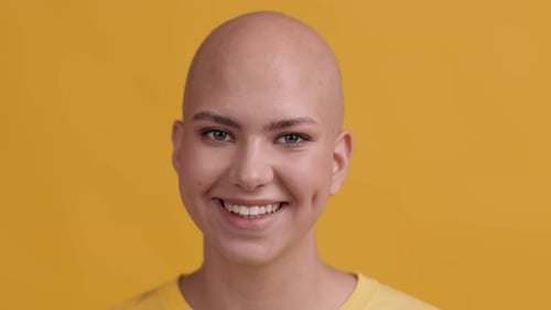 Portrait Of Cheerful Hairless Lady Smiling Posing Over Yellow Background