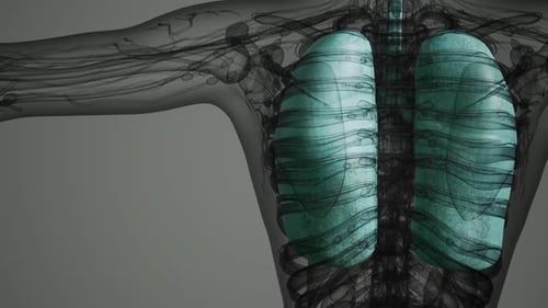 Human Lungs Radiology Exam