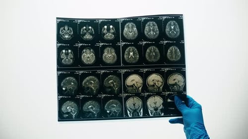 Gloved Hand Holds Brain Scan Image