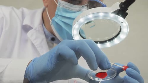 Lab Tech Examines Blood Sample Under Magnifying Glass