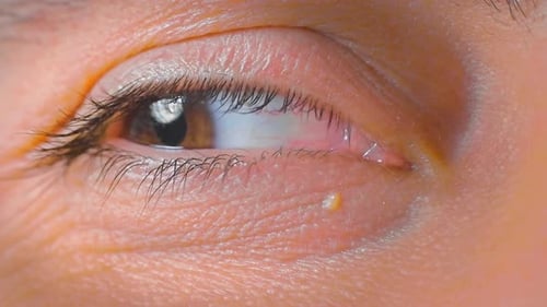 Amber Eye Close-Up, Ophthalmology Concept