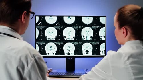 Doctors Studying Brain Scans on Computer Monitor