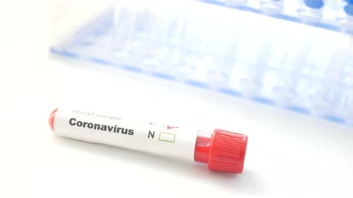 Close Up of Corona Virus Blood Test Tube on White Background