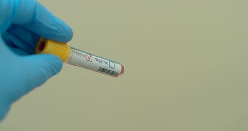 Blood Sample in Test Tube Shows Positive Result