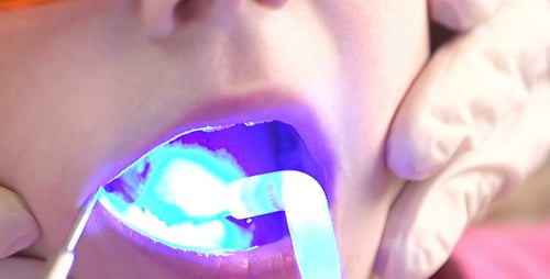 Child Receives Dental Treatment with Blue Light