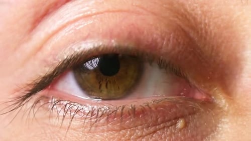 Human Eye Opens Wide in Extreme Close Up