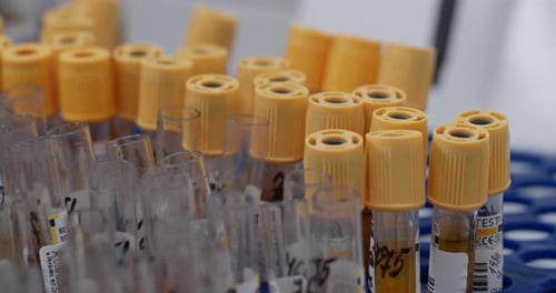 Crop View of Worker in Latex Gloves Taking One Sample From Laboratory Test Equipment Glass Tubes
