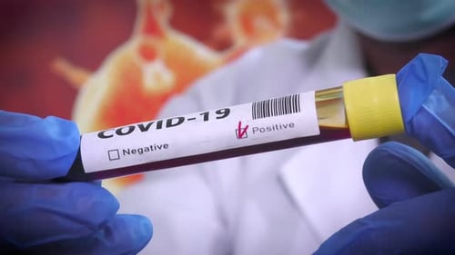 Medical Professional Holding Covid-19 Positive Test Tube