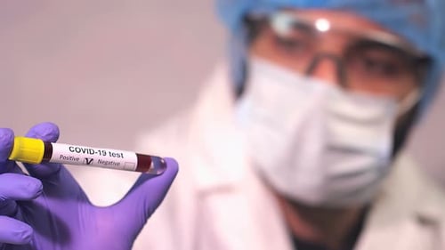 Negative COVID-19 Test Results in Lab