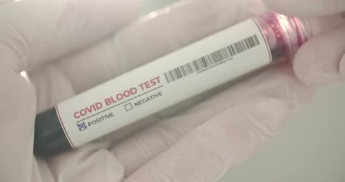 Bluttest in der Hand