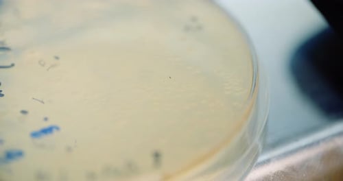 Científico analiza las bacterias en la placa de Petri en el laboratorio