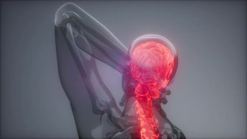 Backache in Back Bones