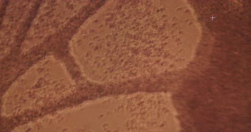 Heart cells pulsating as seen through a microscope