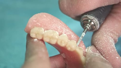 Dentures Being Worked on with High-Speed Drill