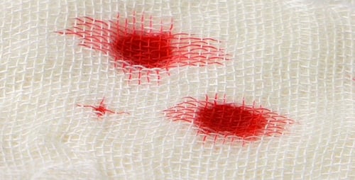 Blood Dropping onto Stack of Gauze Pads