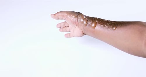 Arm and Hand with Multiple Fluid-Filled Blisters