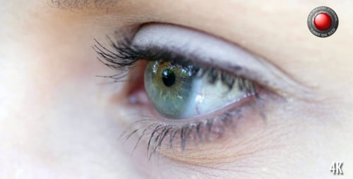 Eye 3