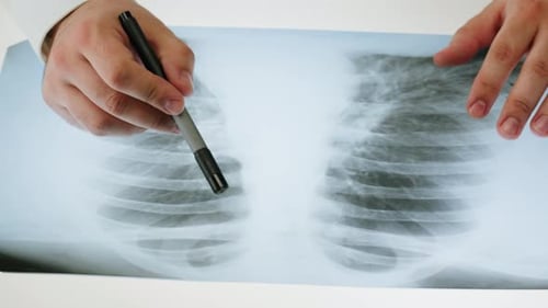 Doctor Reviewing Chest X-Ray With Pen
