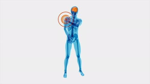 Animated 3D Human Body with Shoulder Pain Highlight