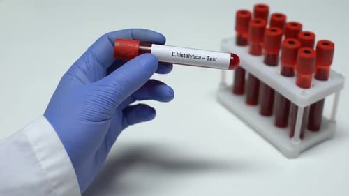 Hand Holding Blood Sample Test Tube
