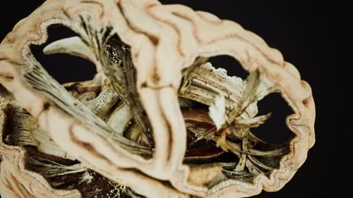 Medizinische Anotomie des echten menschlichen Gehirns
