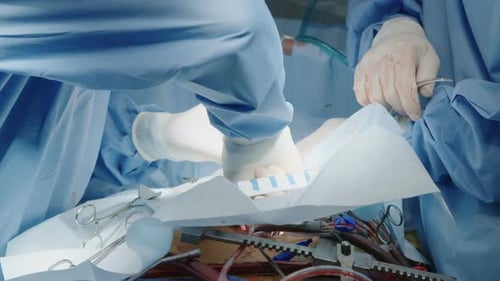 Chirurgen, die während der Operation am offenen Herzen arbeiten, Nahaufnahme von Händen und Instrumenten.