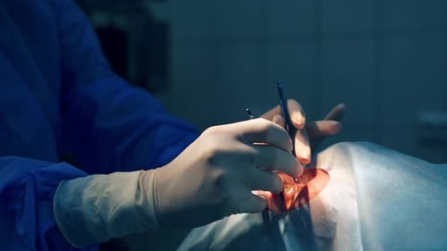 Surgeon operating patient. Surgeon performing operation on the eyes