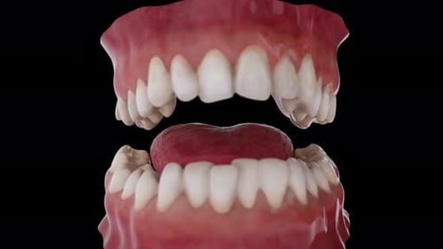 3D Human Jaw, Tongue, and Teeth Animation for Medical Use