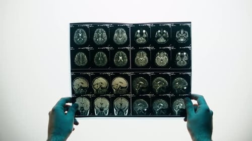 Examining Brain Scan in Clinical Setting