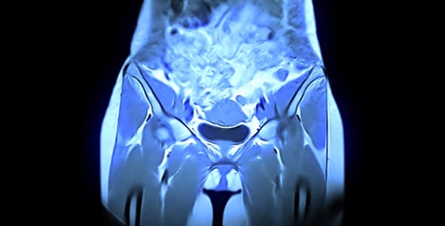 Pelvis And Hips