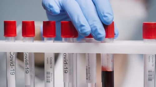Medical Professional Handling Blood Samples in Laboratory