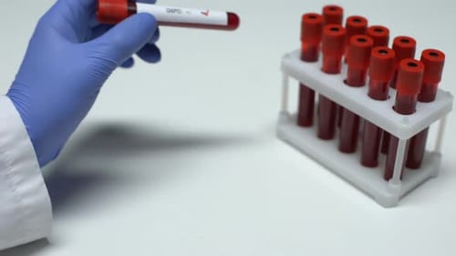 Positive Blood Test Vial Held in Gloved Hand