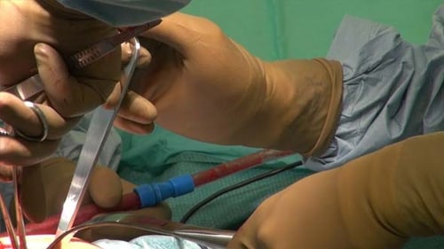 Surgeons Performing Delicate Medical Procedure in Hospital