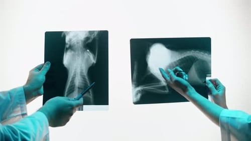 Medical Professionals Examining X-rays in Hospital Setting