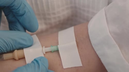 Close Up of IV Drip in Patient Arm