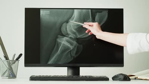 Doctor Veterinarian Examining Horse Leg Skeleton Roentgen on Computer Monitor