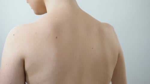 Physician Examining Birthmark With Magnifying Glass, Diagnosis of Skin Cancer