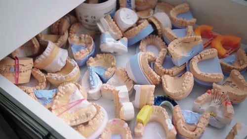 Dental Impressions and Tooth Molds in Drawer
