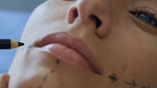 Woman Having Markings Drawn on Face for Procedure
