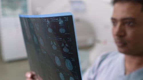 Male Doctor Looking at MRI Scan