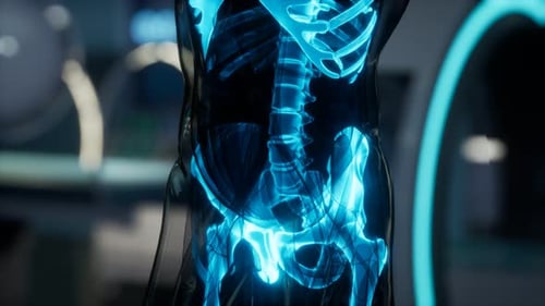 Human Skeleton Bones Scan Exam in Lab