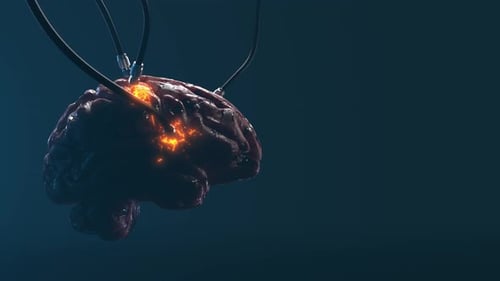 Artificial Intelligence. image of the brain with different dachiks connected