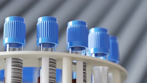 Medical Lab Blood Test Tubes Spinning Rack