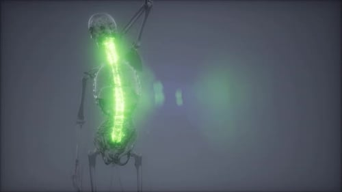 Backache in Back Bones
