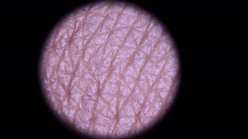 Magnified View of Skin Cells Under Microscope