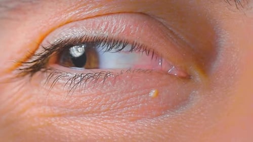 Auge