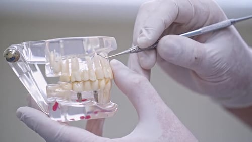 Dentist Demonstrates Technique on Tooth Model