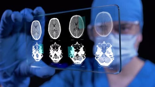 Doctor Examining Futuristic Brain Scan on Transparent Device