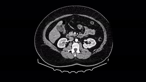 Attentive Radiologist Examining MRI x Ray at the Clinic