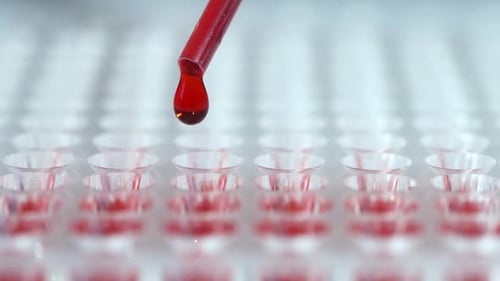 Lab Technician Performs a Blood Test in the Laboratory